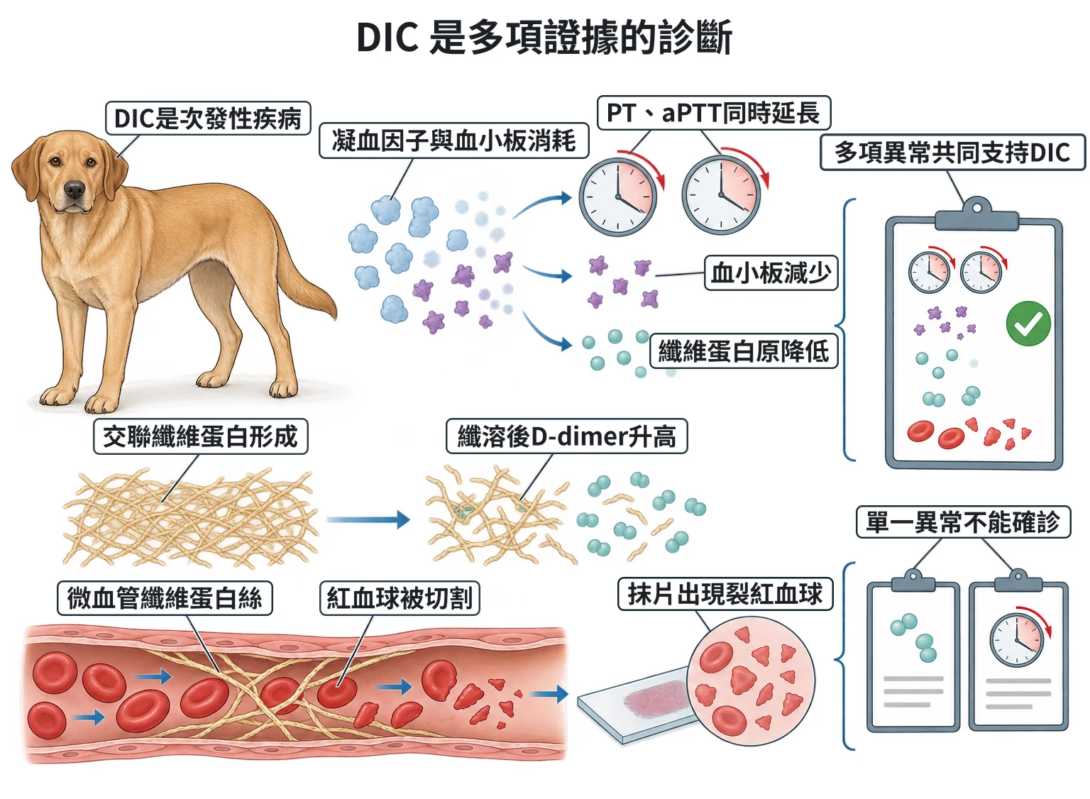DIC 是多項證據的診斷教學插圖