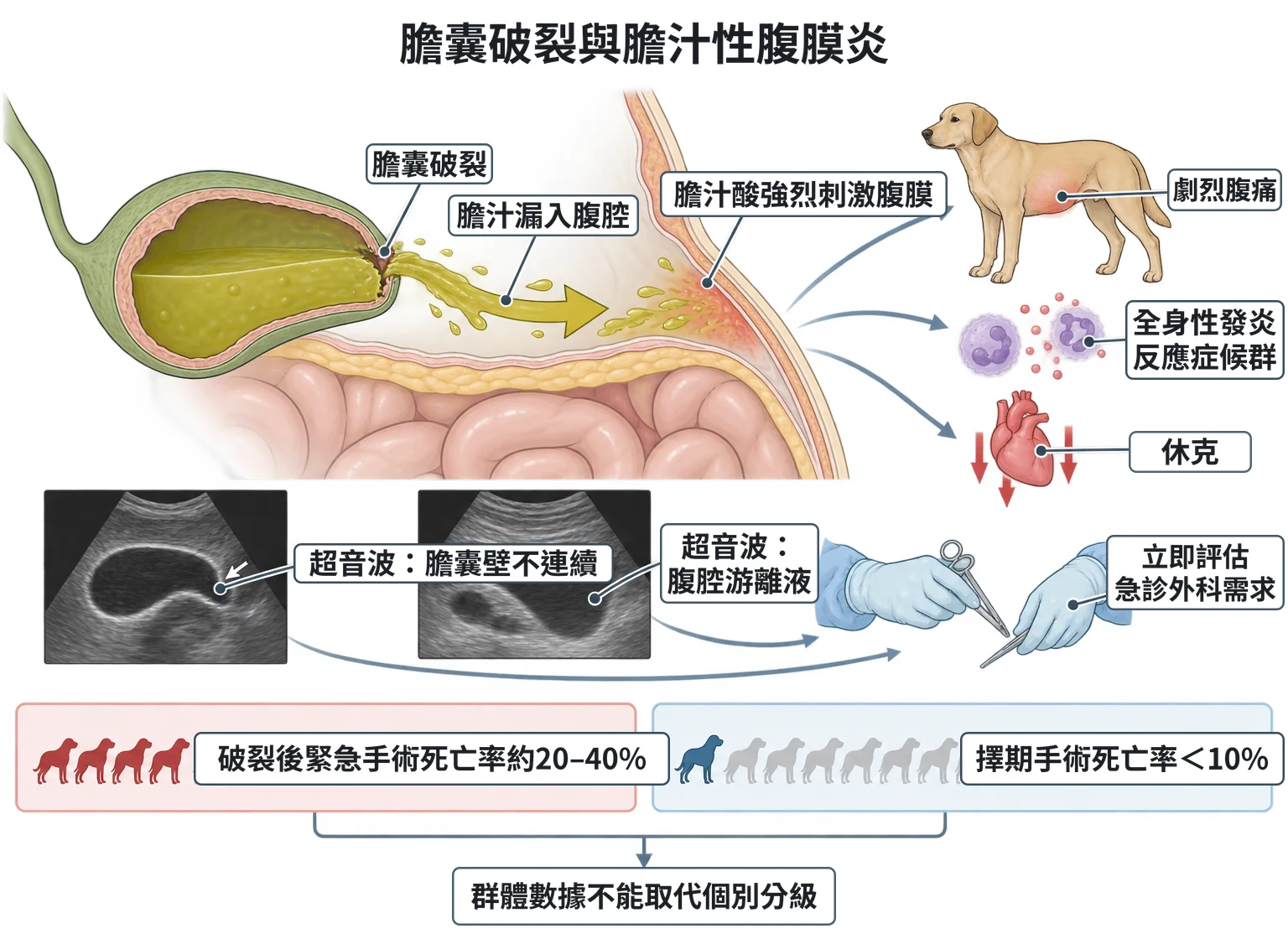膽囊破裂與膽汁性腹膜炎教學插圖