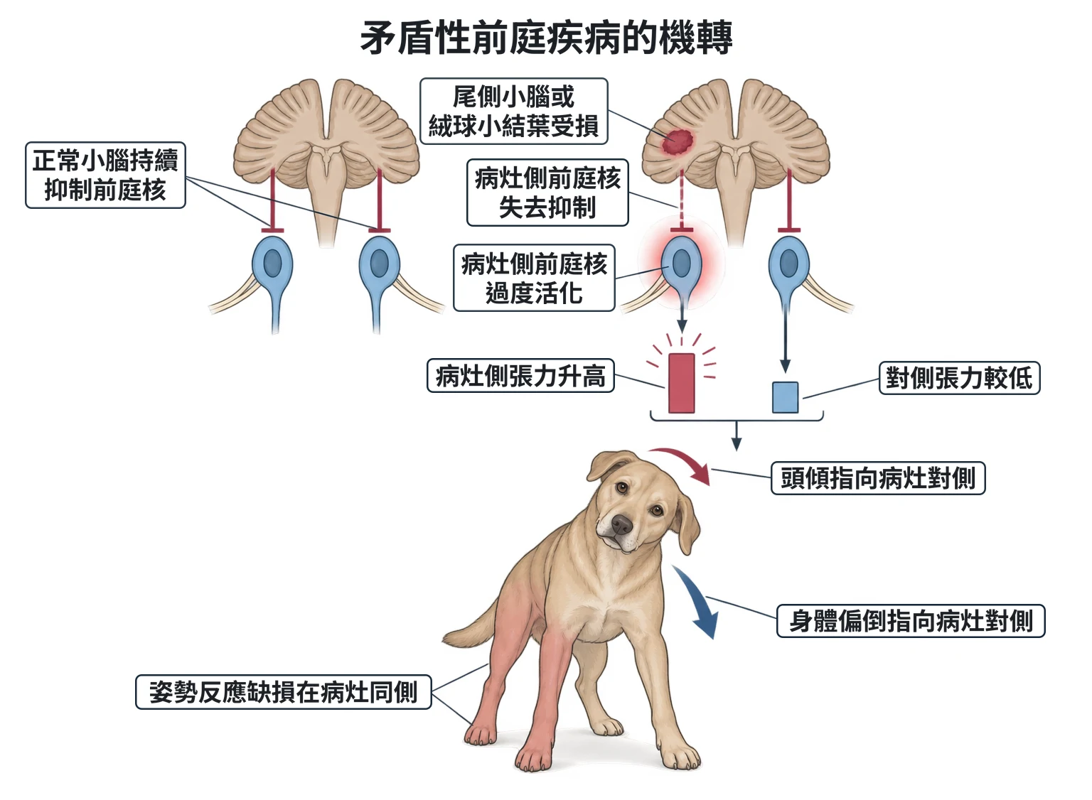 矛盾性前庭疾病的機轉教學插圖