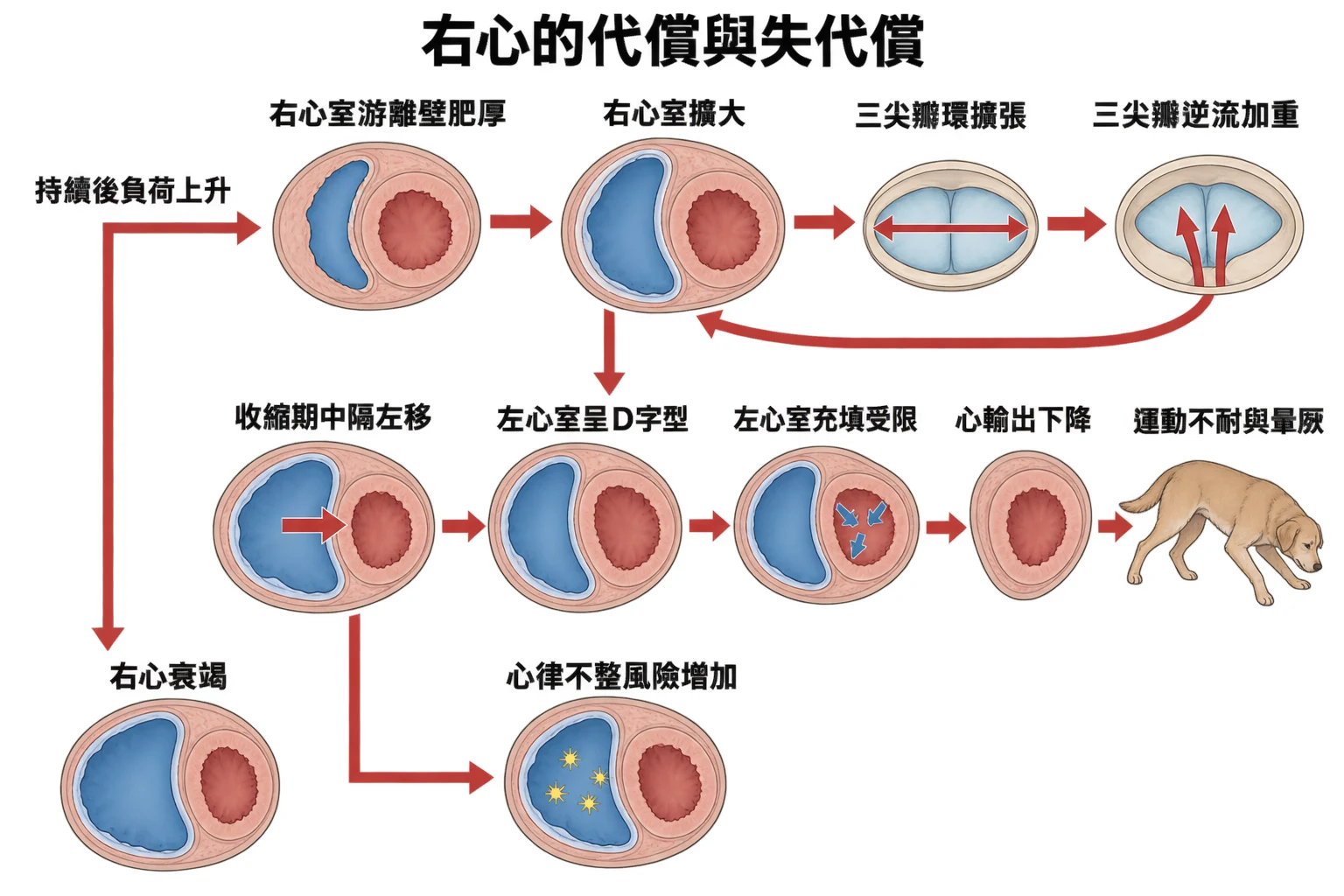 右心的代償與失代償教學插圖