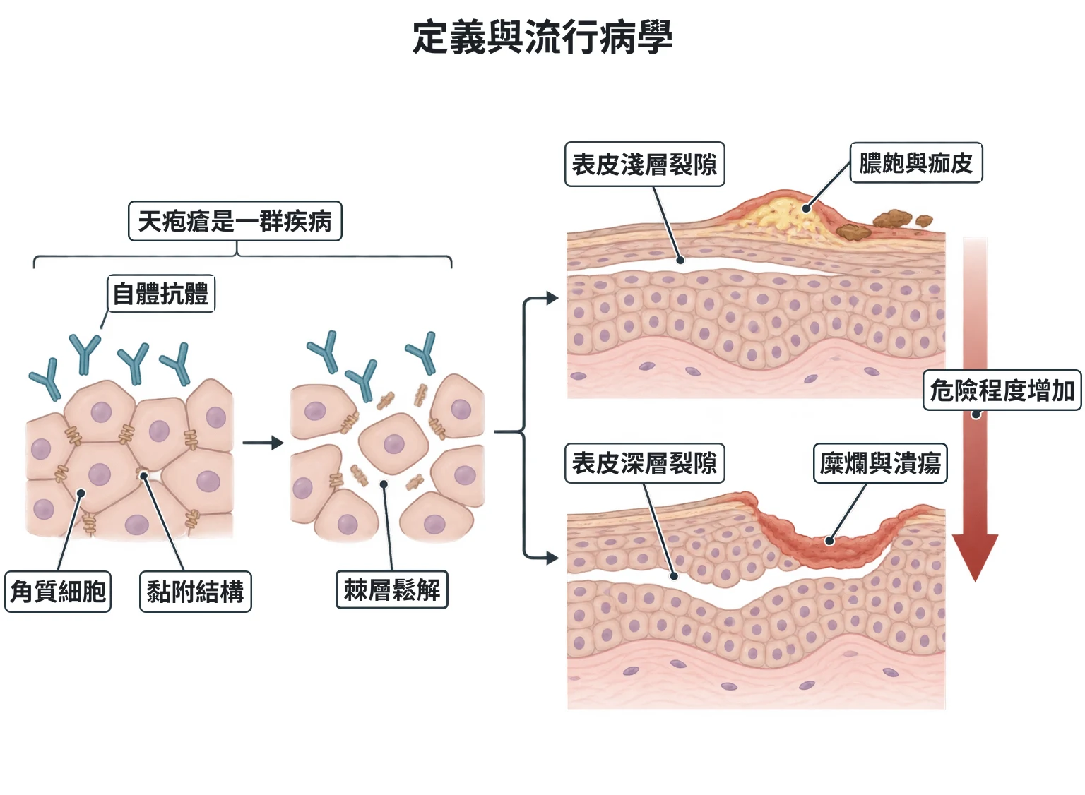 定義與流行病學教學插圖