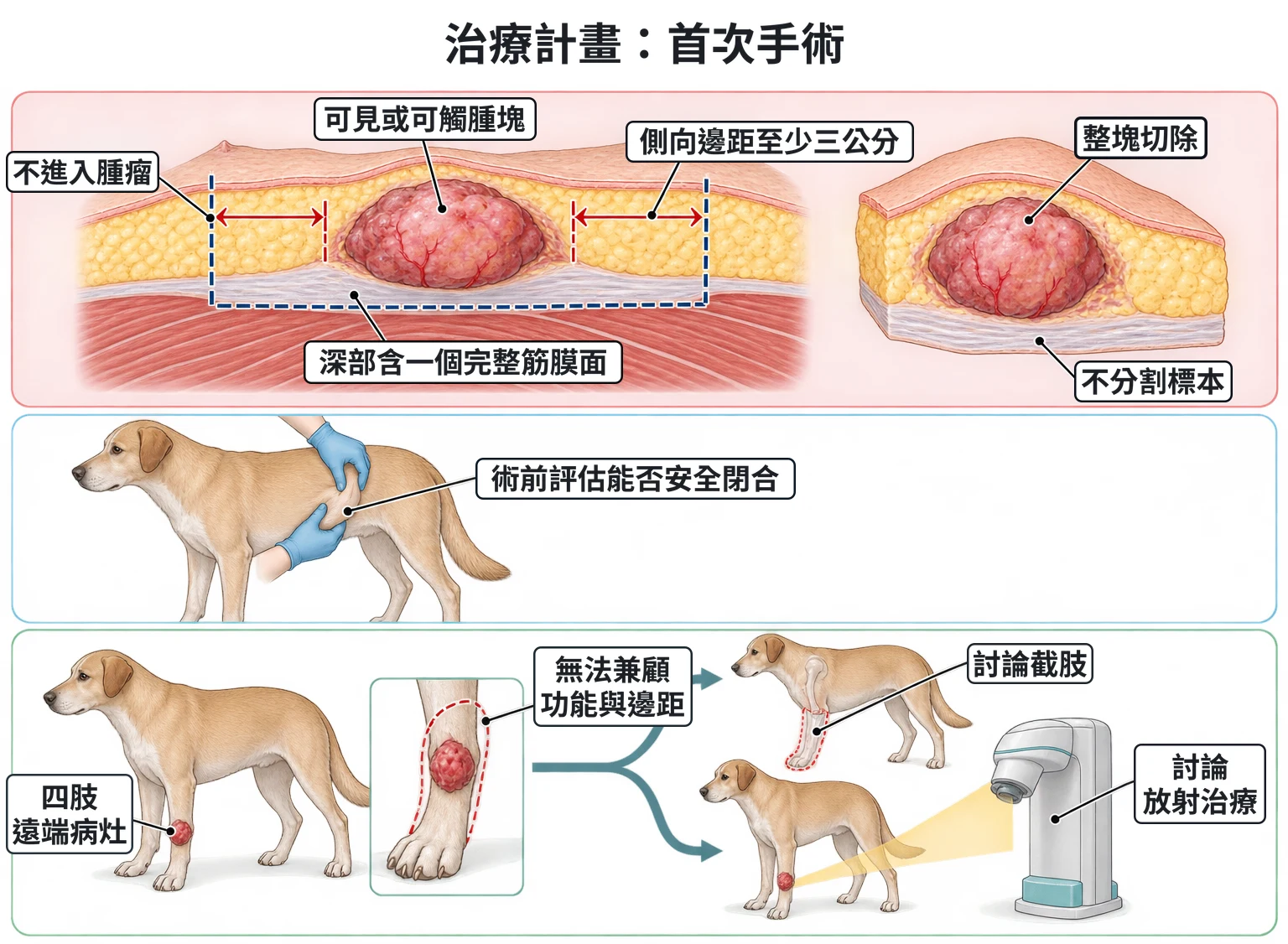 治療計畫:首次手術教學插圖
