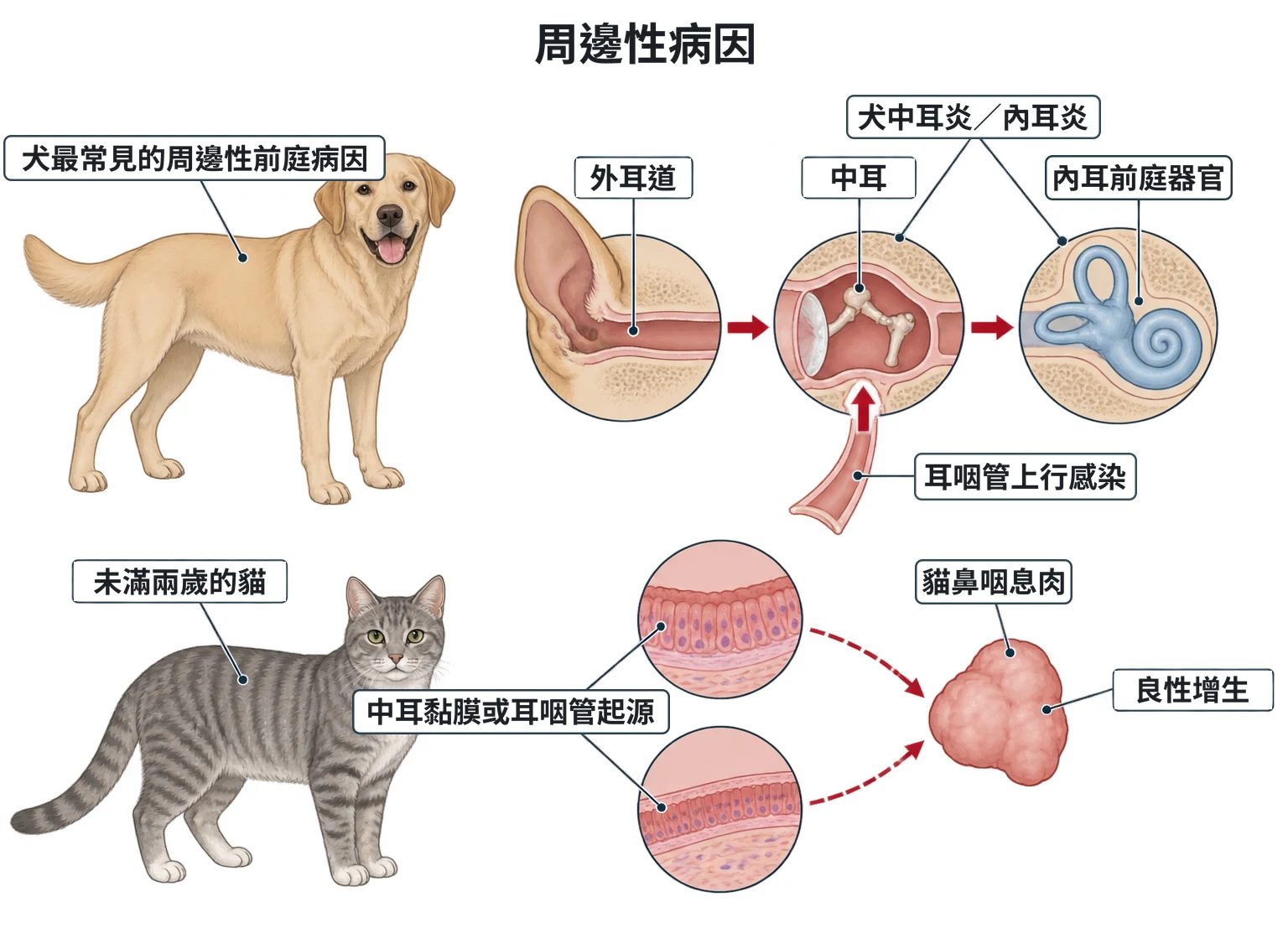 周邊性病因教學插圖