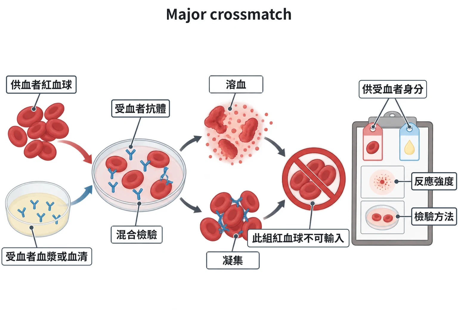 Major crossmatch教學插圖