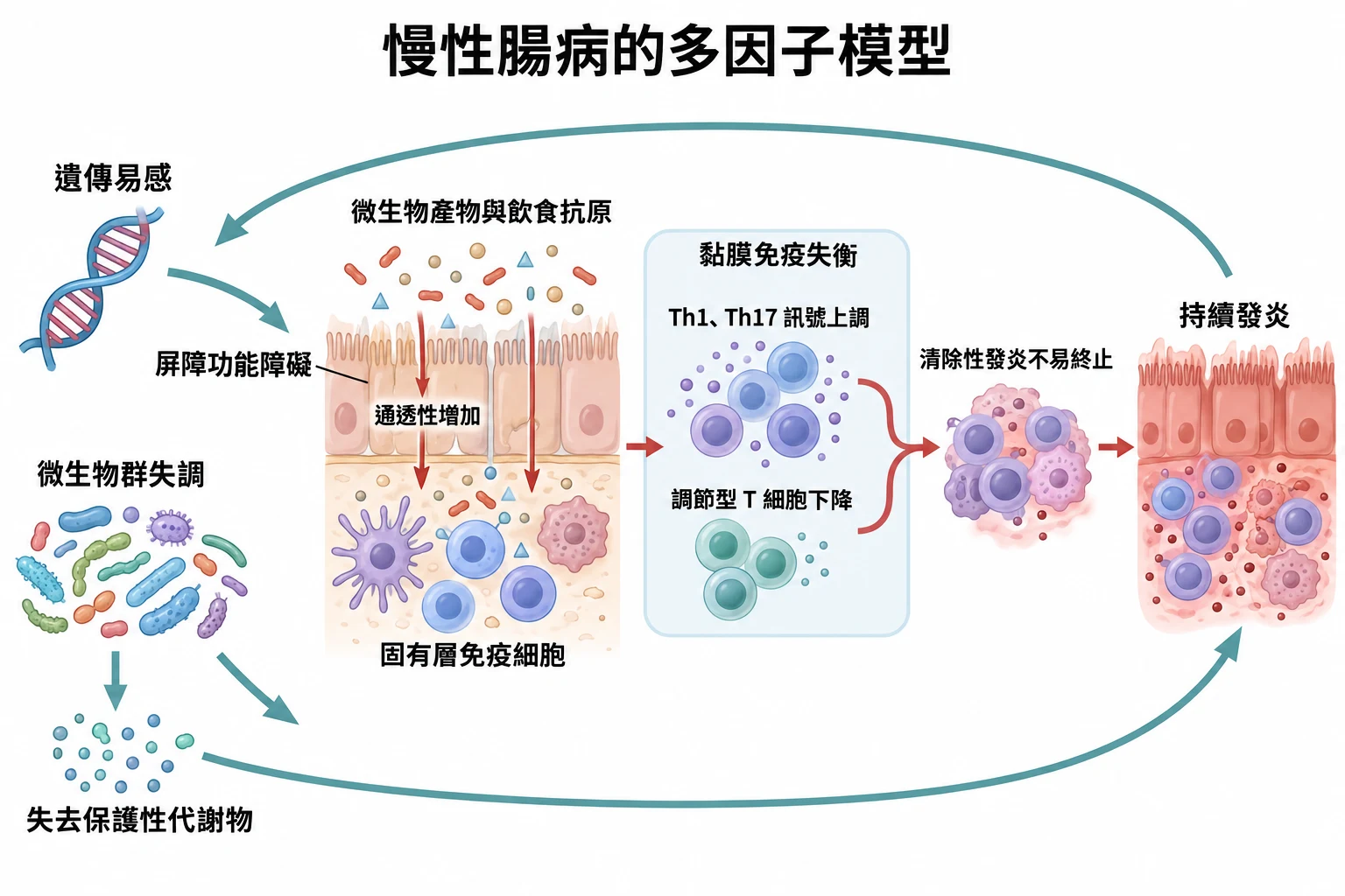 慢性腸病的多因子模型教學插圖
