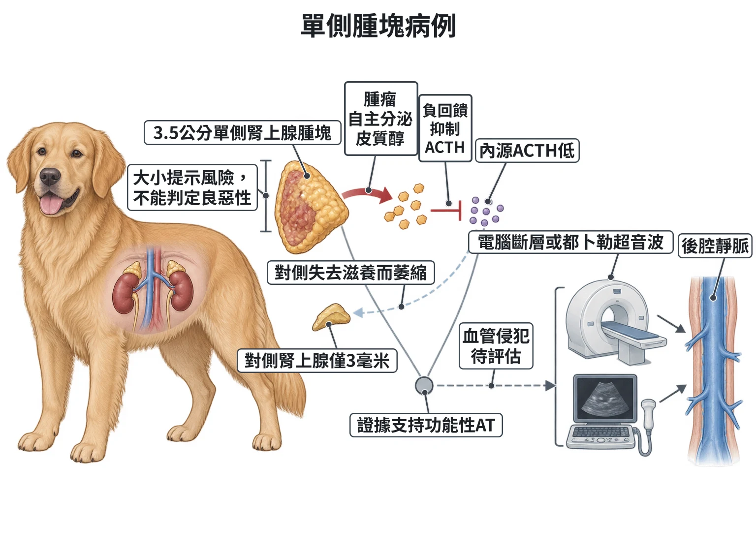 單側腫塊病例教學插圖