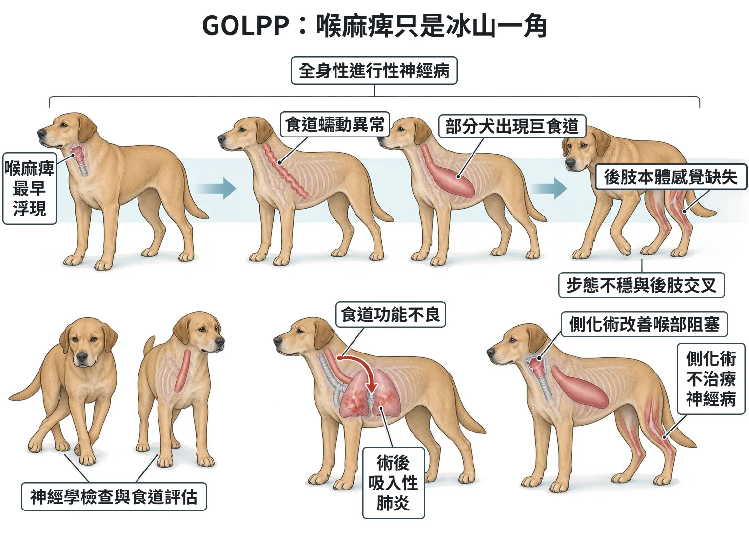 GOLPP:喉麻痺只是冰山一角教學插圖