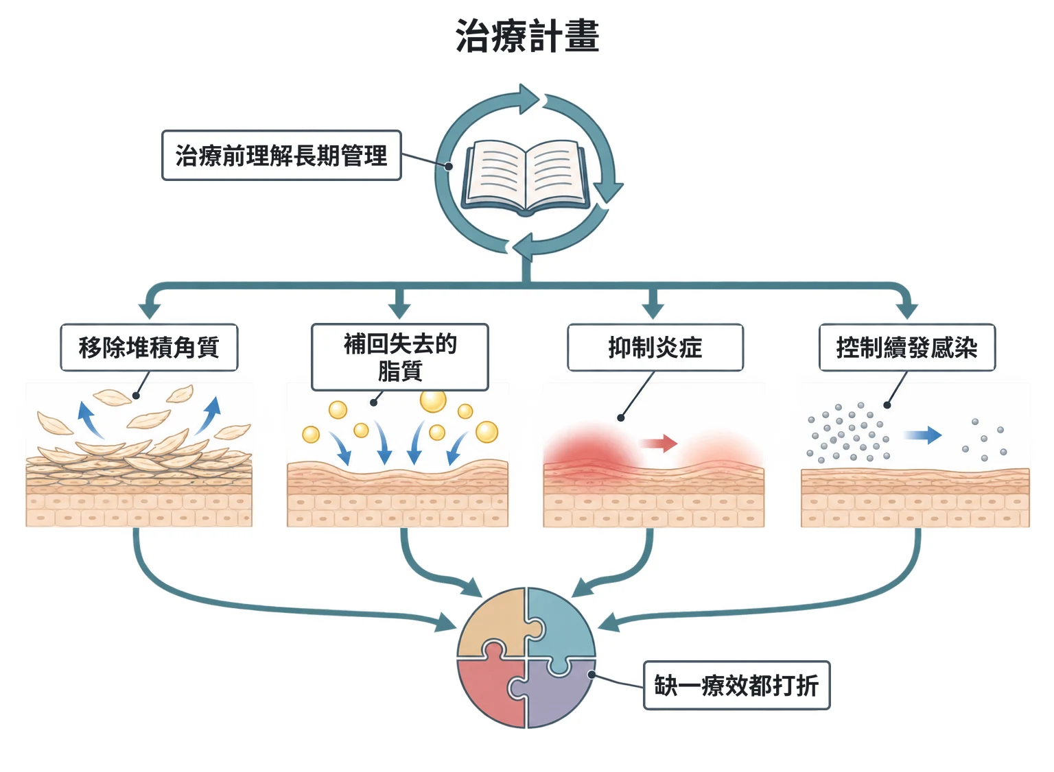 治療計畫教學插圖