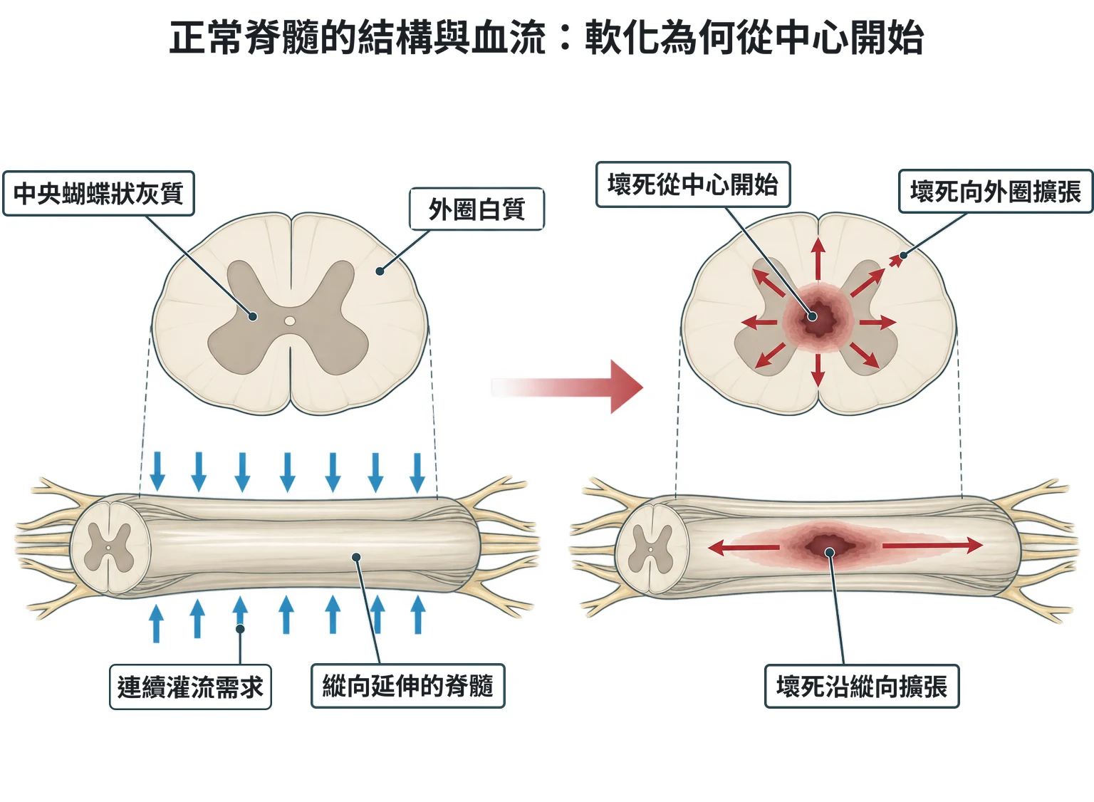 正常脊髓的結構與血流:軟化為何從中心開始教學插圖