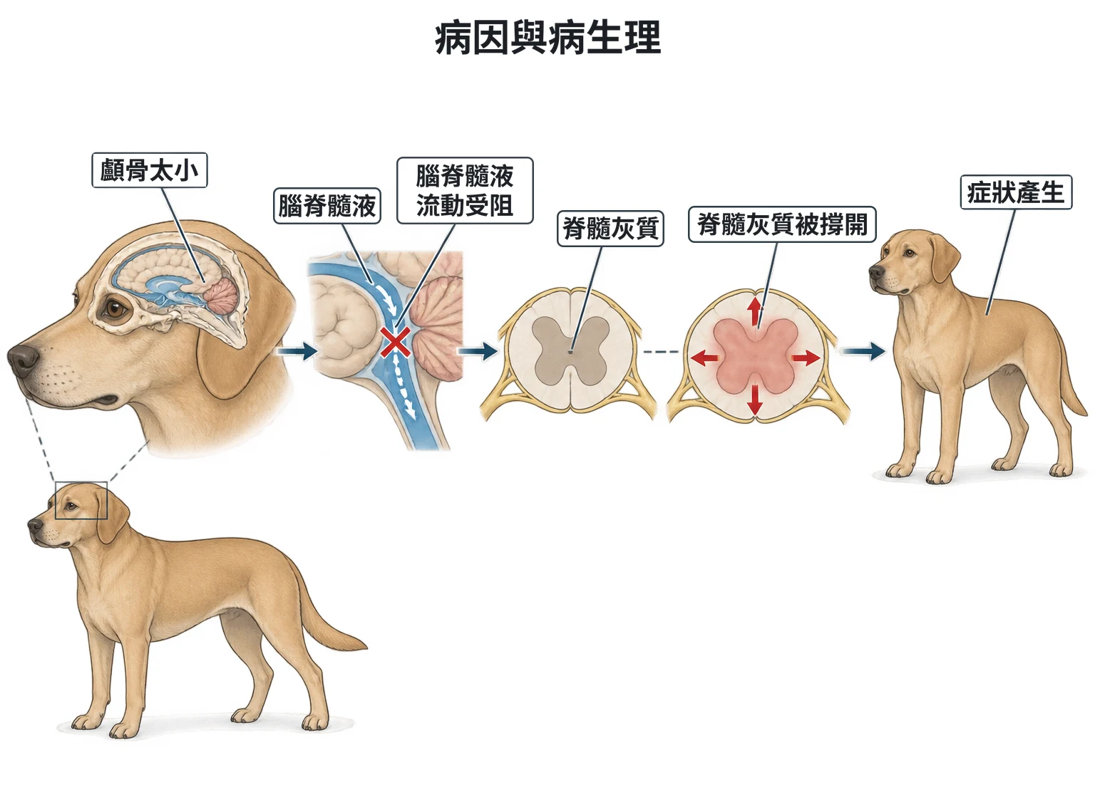 病因與病生理教學插圖