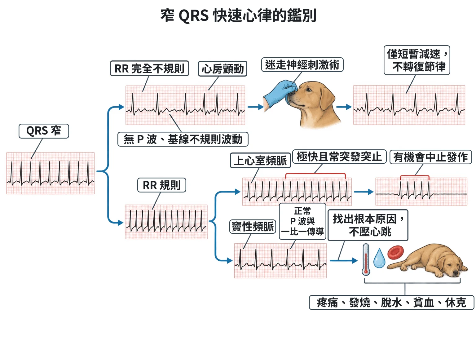 窄 QRS 快速心律的鑑別教學插圖