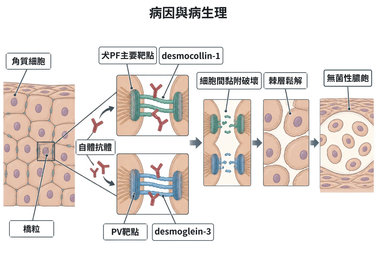 病因與病生理教學插圖