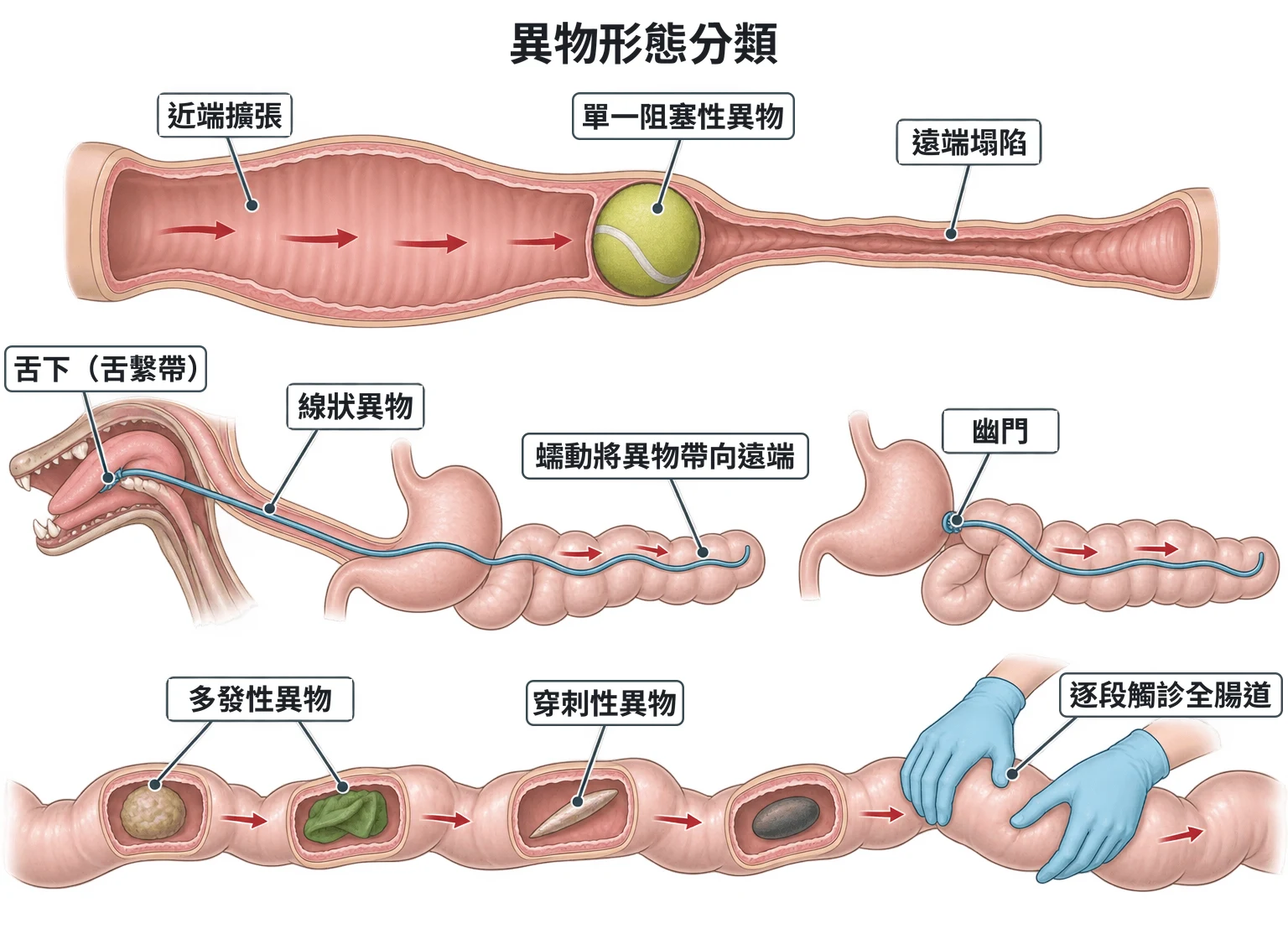 異物形態分類教學插圖