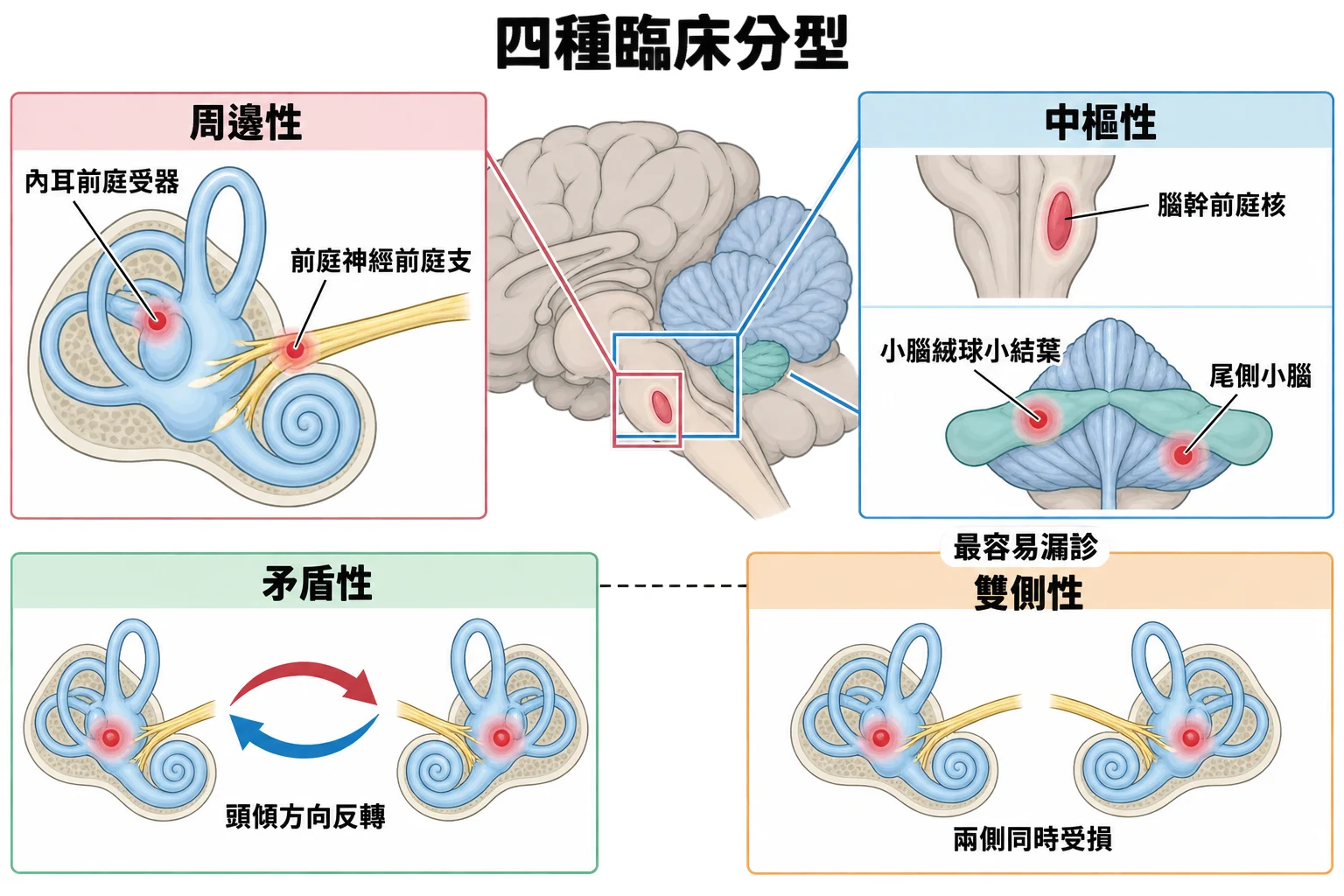 四種臨床分型教學插圖