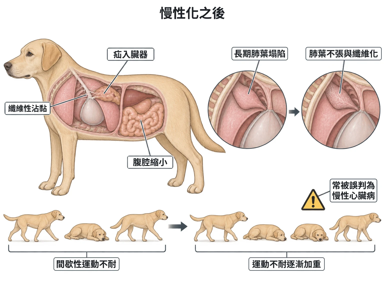 慢性化之後教學插圖