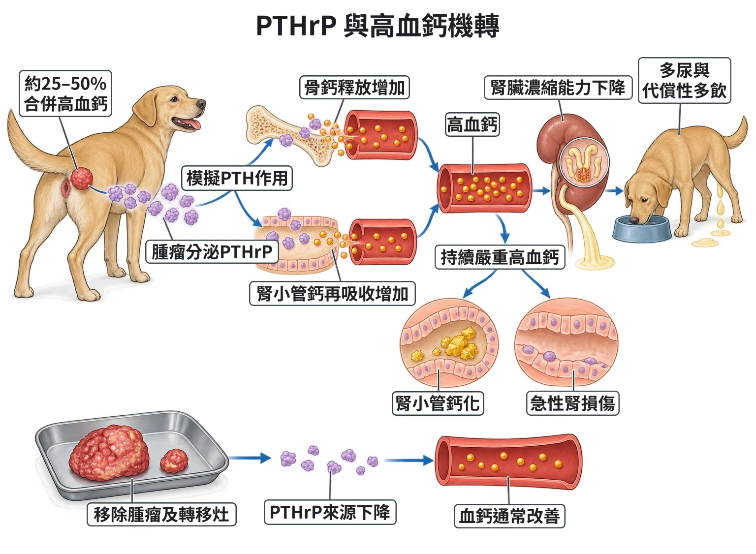 PTHrP 與高血鈣機轉教學插圖