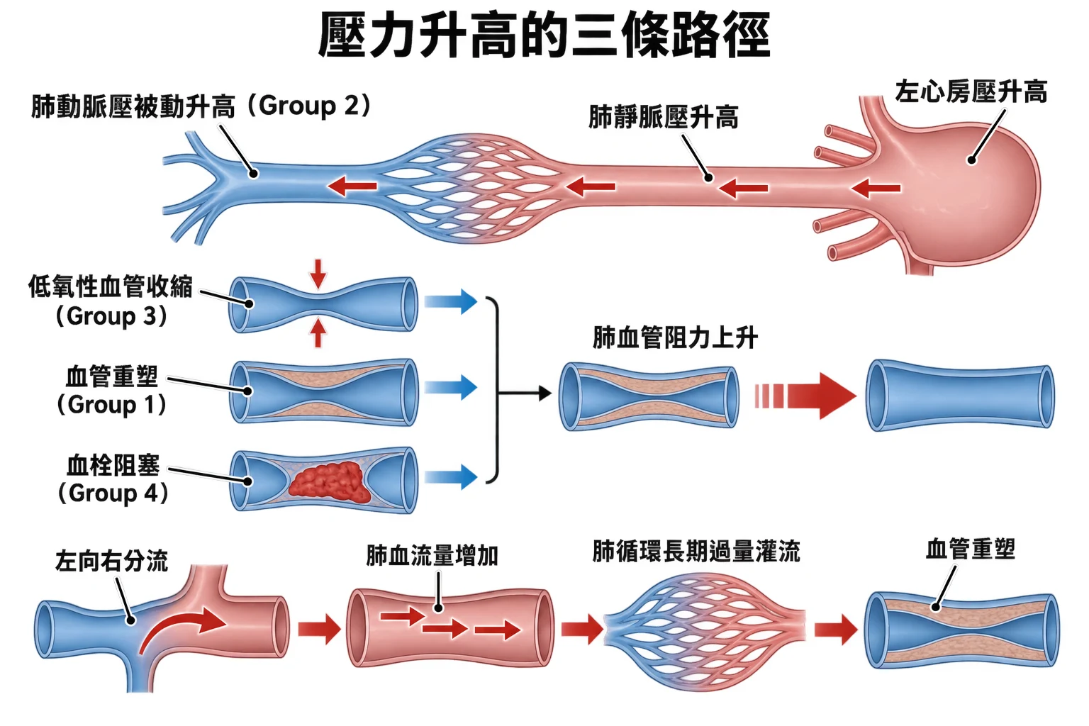 壓力升高的三條路徑教學插圖