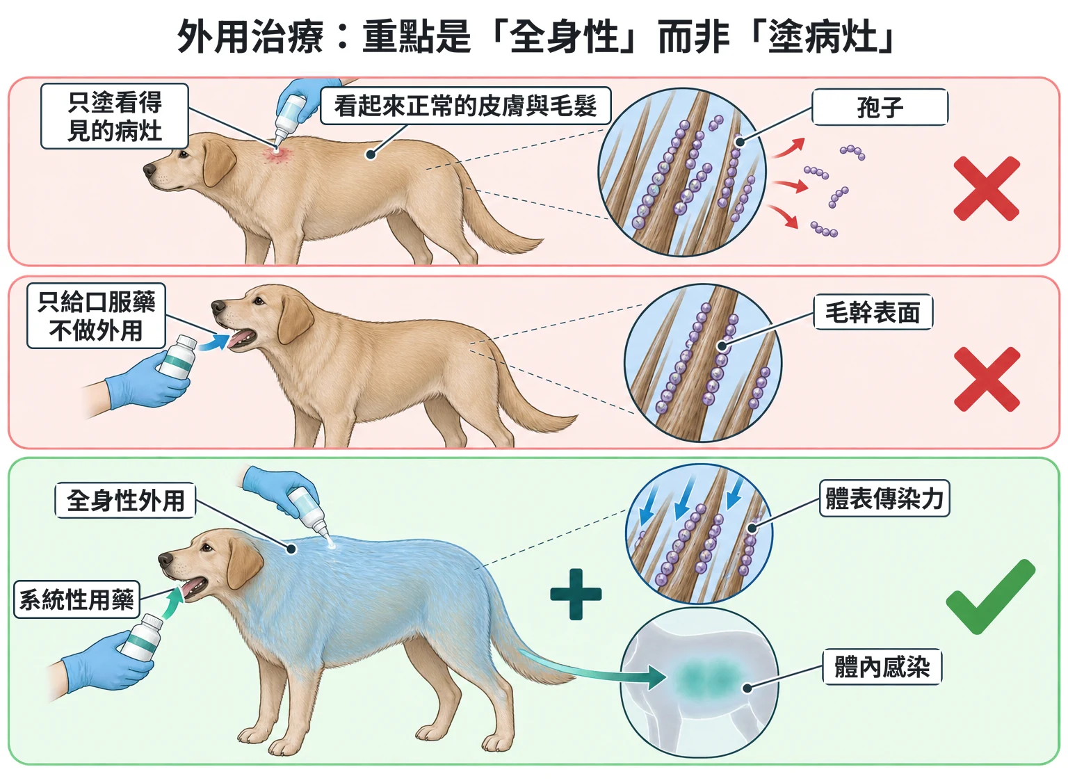 外用治療:重點是「全身性」而非「塗病灶」教學插圖