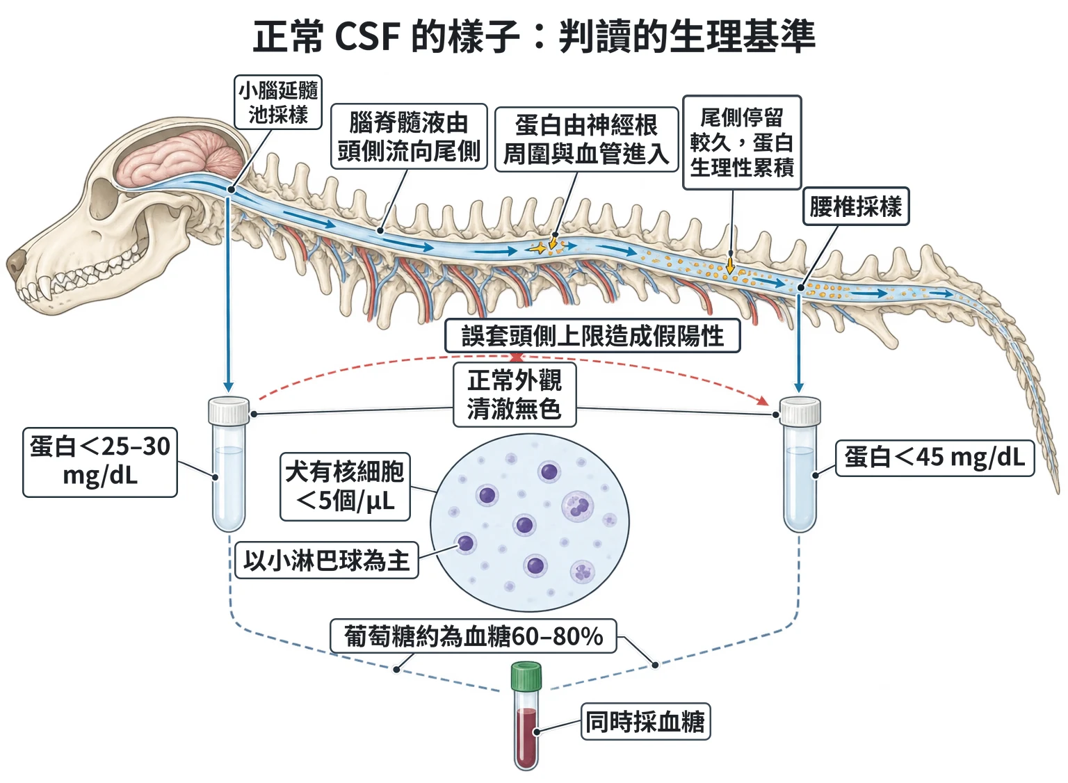 正常 CSF 的樣子:判讀的生理基準教學插圖