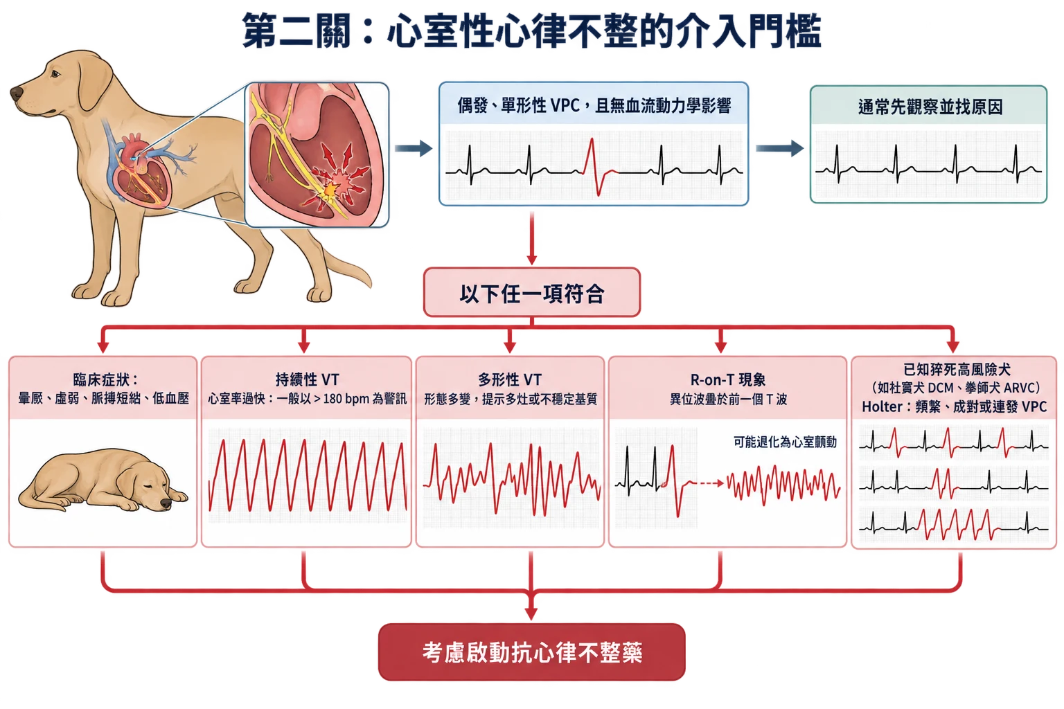 第二關:心室性心律不整的介入門檻教學插圖
