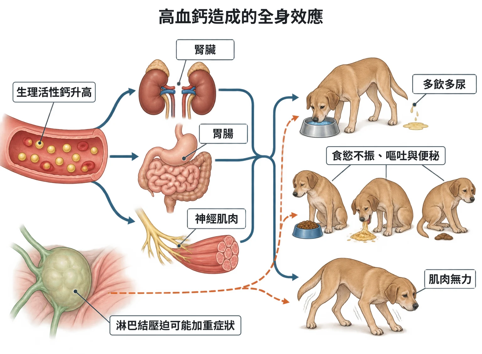 高血鈣造成的全身效應教學插圖
