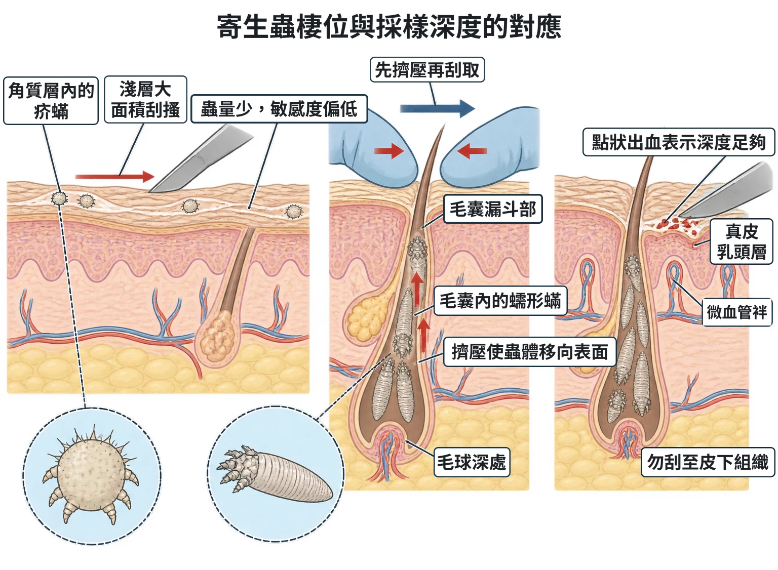 寄生蟲棲位與採樣深度的對應教學插圖