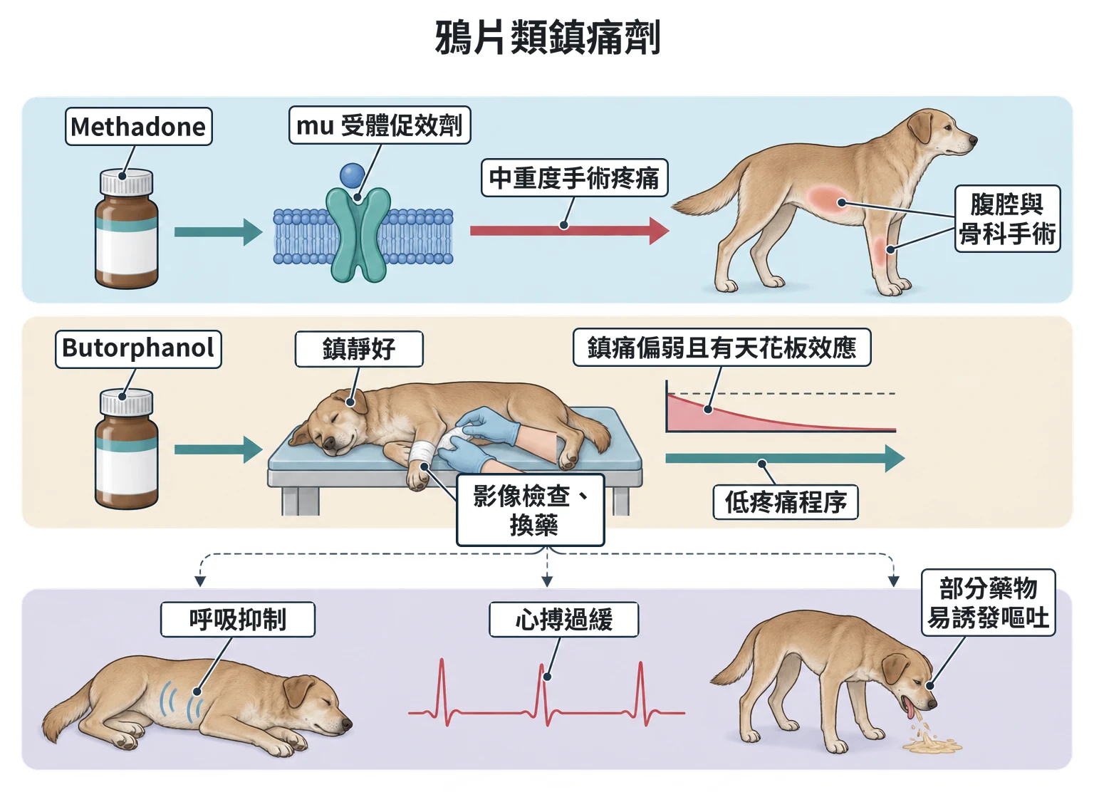 鴉片類鎮痛劑教學插圖