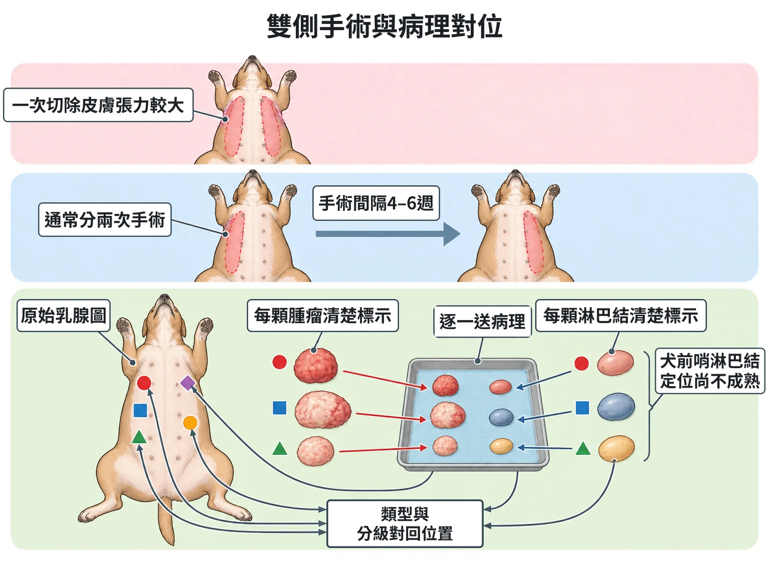 雙側手術與病理對位教學插圖