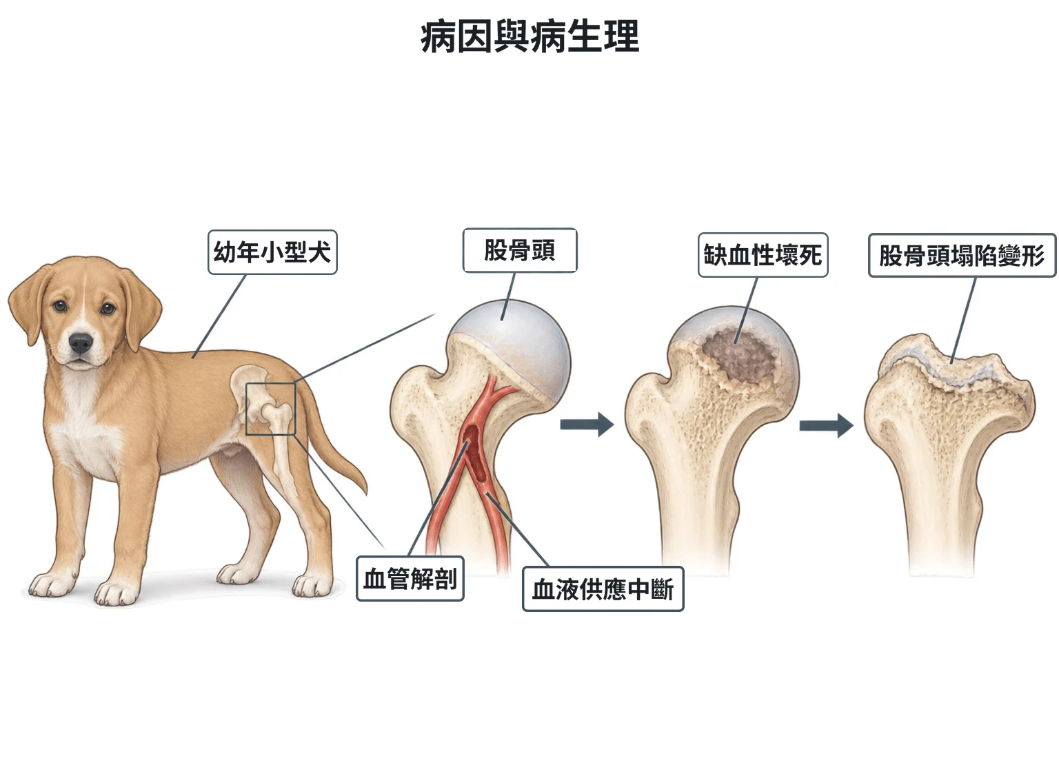 病因與病生理教學插圖