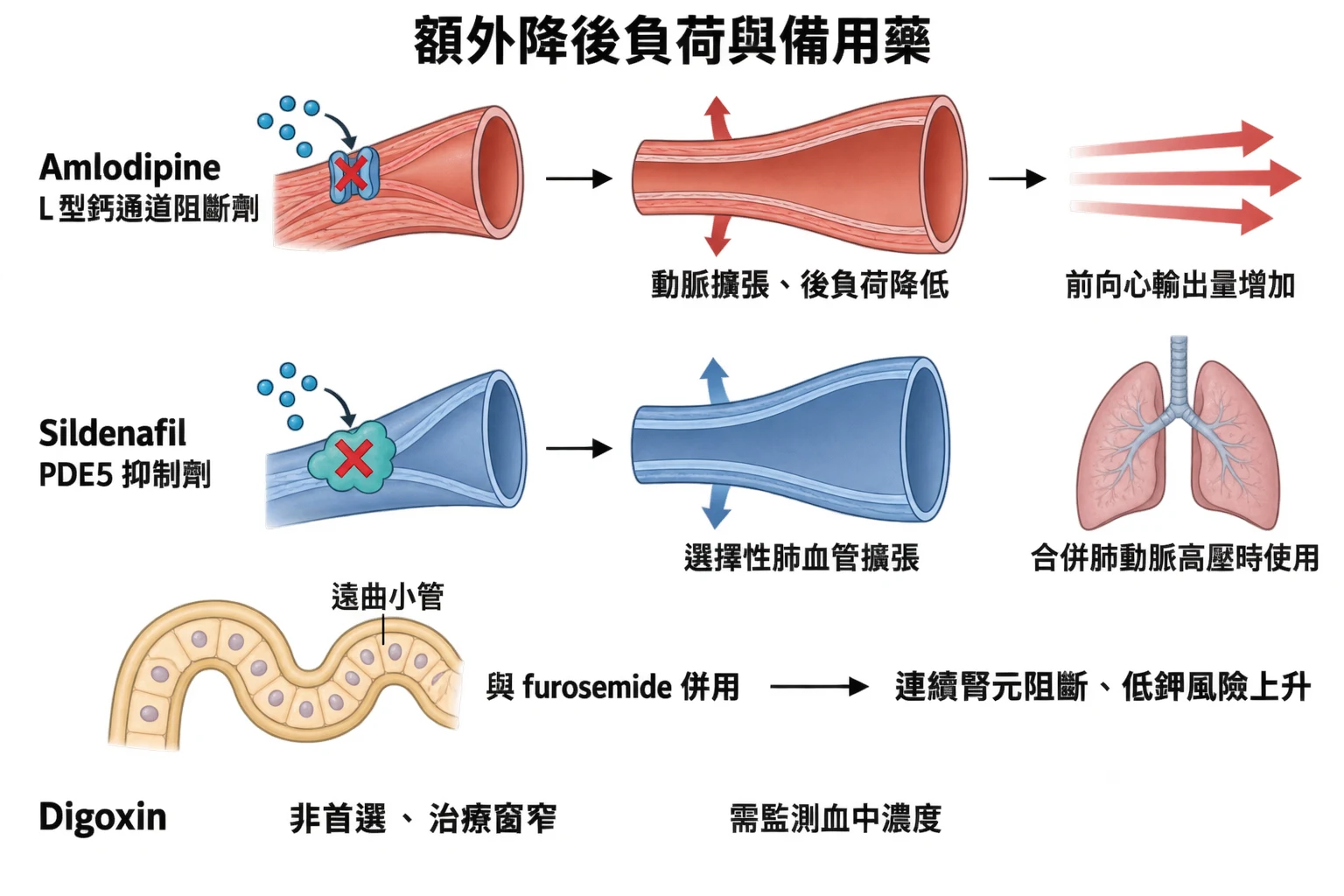 額外降後負荷與備用藥教學插圖