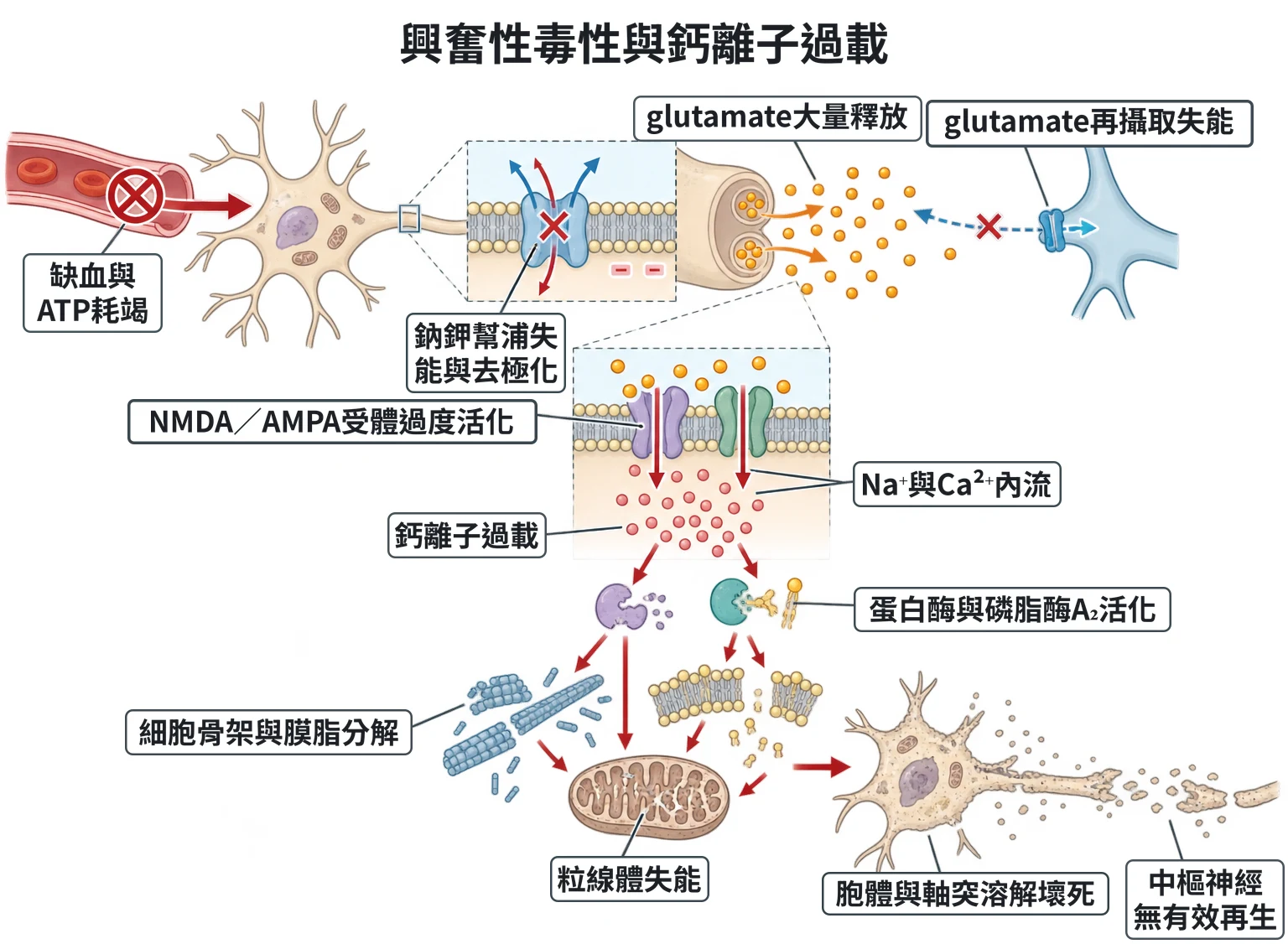 興奮性毒性與鈣離子過載教學插圖