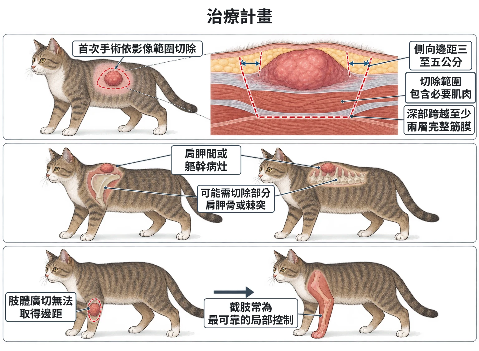治療計畫教學插圖