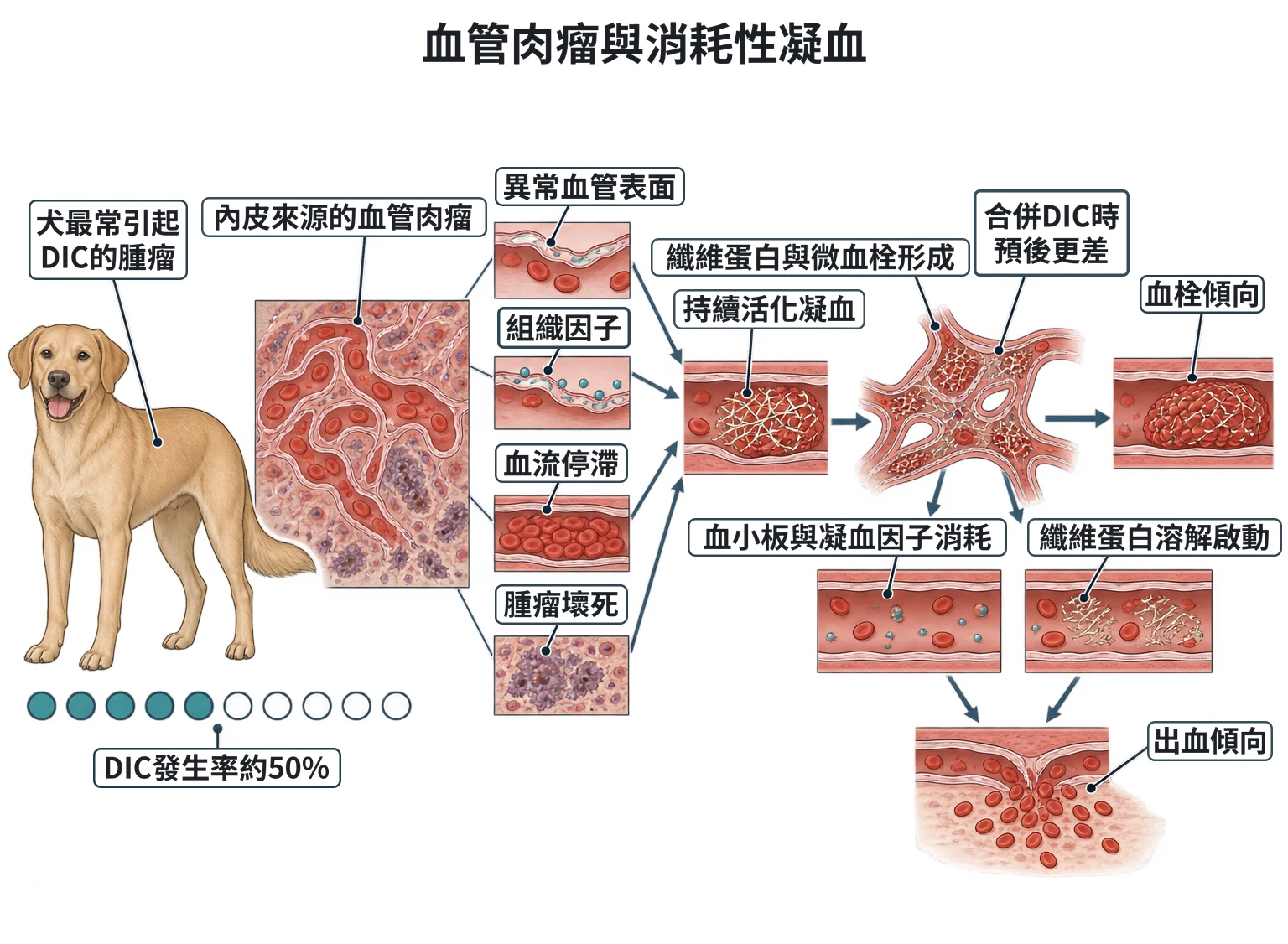 血管肉瘤與消耗性凝血教學插圖