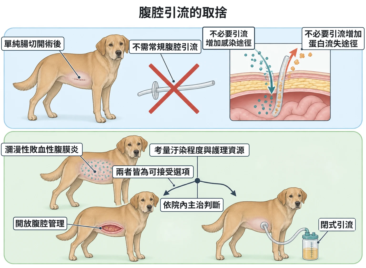 腹腔引流的取捨教學插圖
