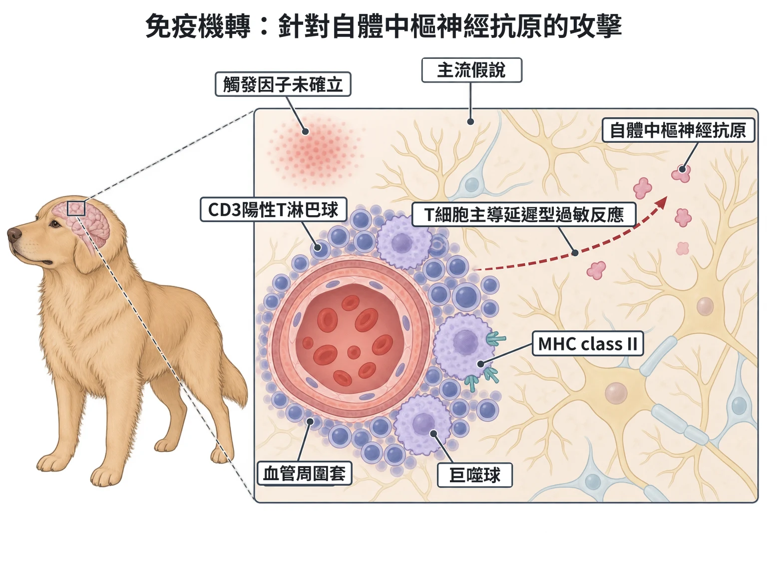 免疫機轉:針對自體中樞神經抗原的攻擊教學插圖