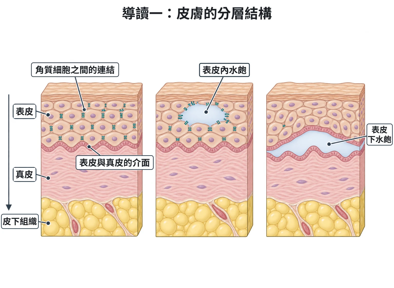 導讀一:皮膚的分層結構教學插圖