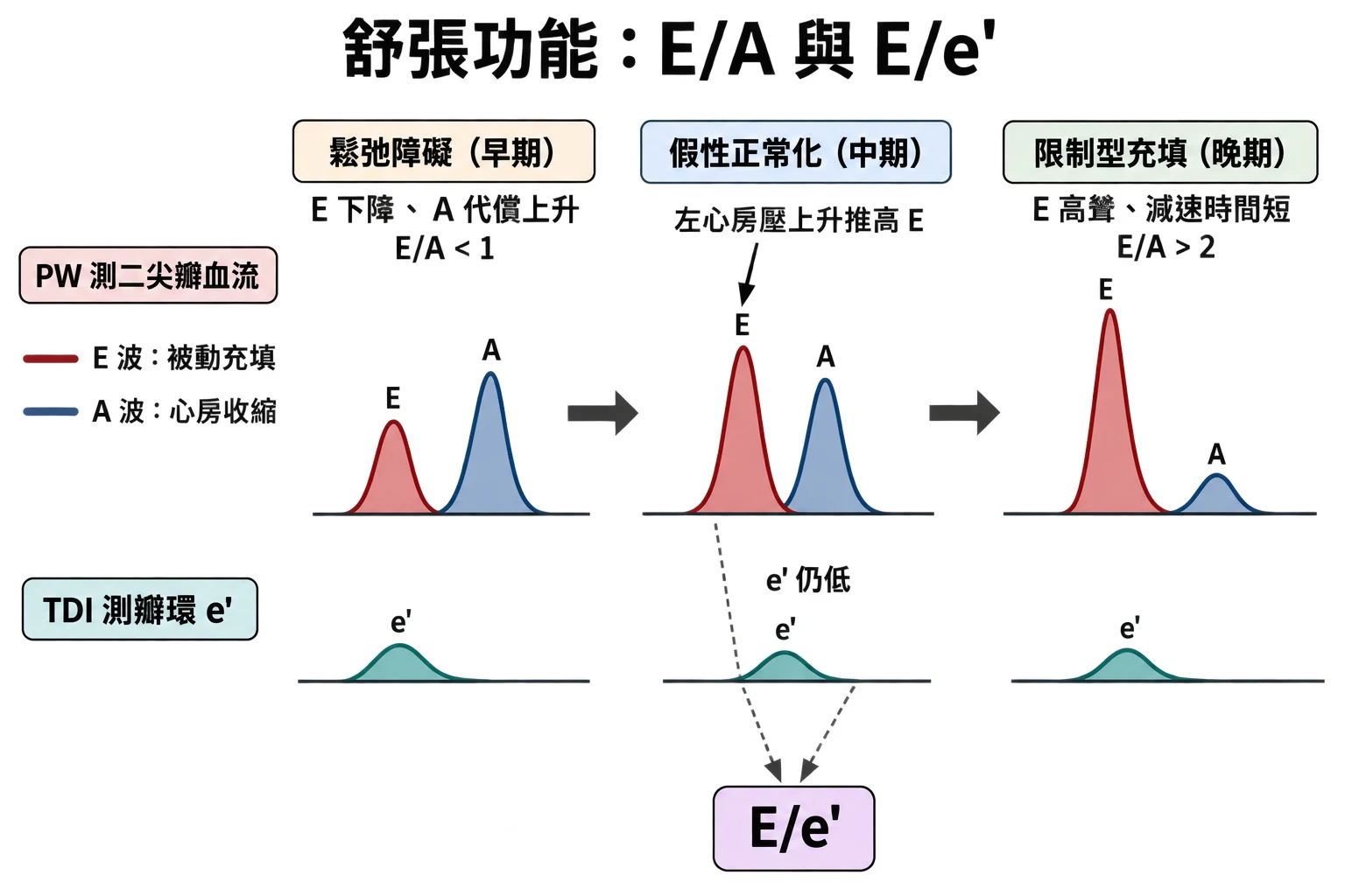 舒張功能:E/A 與 E/e'教學插圖