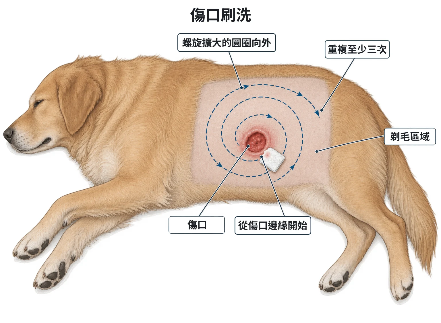 傷口清潔示意圖：側臥患者腹側的剃毛區域中央有一處開放傷口，虛線螺旋箭頭從傷口邊緣開始、以越來越大的圓圈向外繞到剃毛區域邊緣