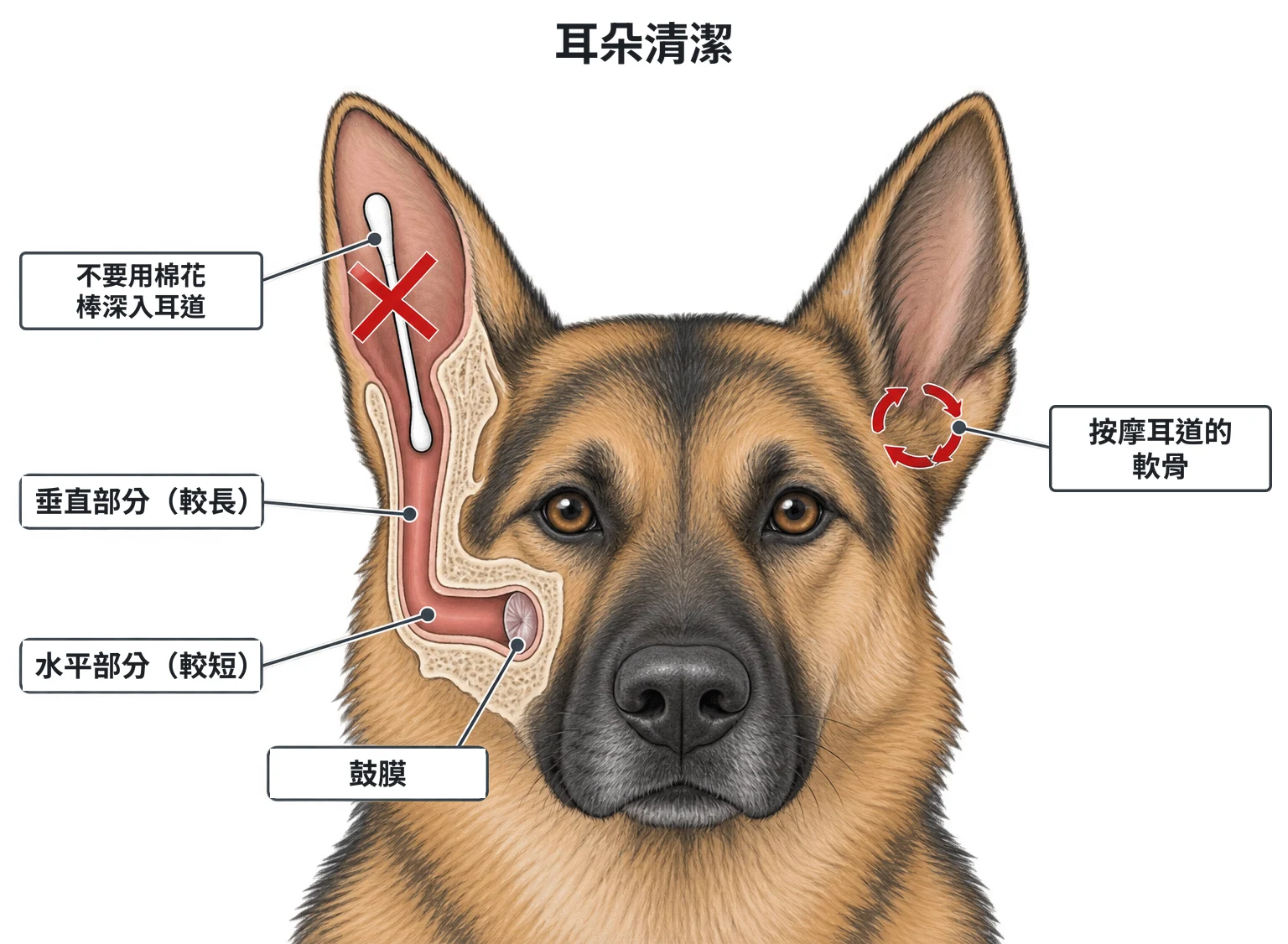 耳朵清潔示意圖：患者頭部正面，一側耳朵畫成剖面，耳道從耳根沿頭側往下為較長的垂直部分、再轉向頭部中線為較短的水平部分，止於鼓膜；深入耳道的棉花棒打紅叉；另一側耳根下方以小圓圈箭頭表示按摩耳道軟骨的位置