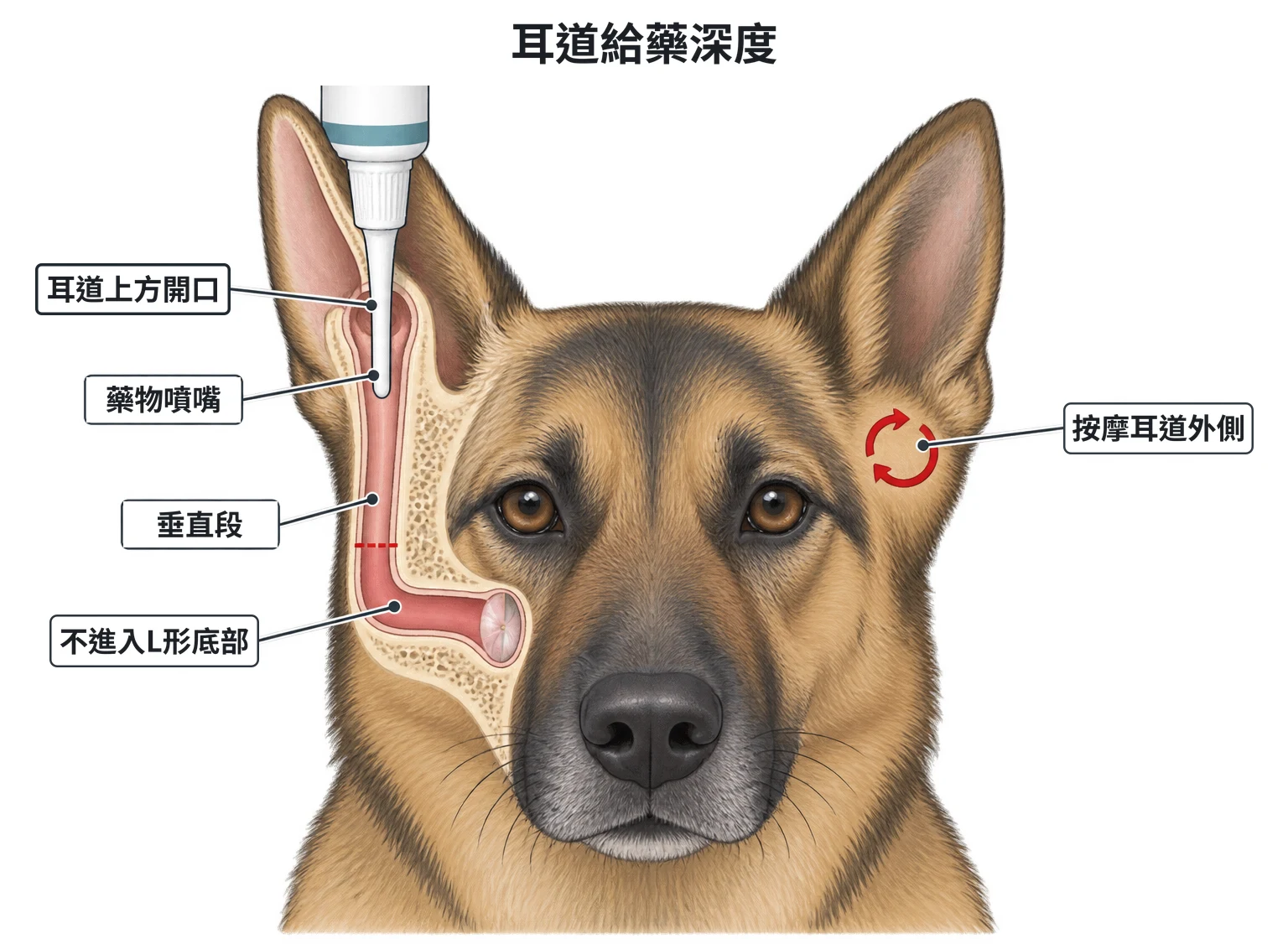 耳部給藥示意圖：患者頭部正面，一側耳朵畫成剖面，耳道呈 L 形；給藥瓶噴嘴從耳道上方開口伸入、只停在垂直段，轉彎處上方畫紅色虛線，虛線以下的轉彎與水平段標為不可進入；另一側耳根下方以小圓圈箭頭表示按摩耳道外側