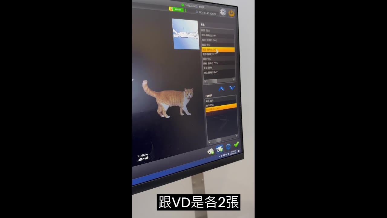 X 光影像系統畫面，體位清單選取腹部腹背位（VD），已選清單列出三個體位